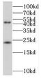 MID1 Interacting Protein 1 antibody, FNab05181, FineTest, Western Blot image 