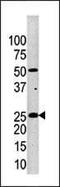 Kallikrein Related Peptidase 4 antibody, PA5-13344, Invitrogen Antibodies, Western Blot image 