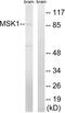 Ribosomal Protein S6 Kinase A5 antibody, abx012925, Abbexa, Western Blot image 