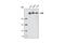 ATM Serine/Threonine Kinase antibody, 2873S, Cell Signaling Technology, Western Blot image 