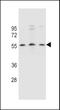 Potassium Two Pore Domain Channel Subfamily K Member 18 antibody, LS-C165440, Lifespan Biosciences, Western Blot image 