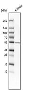 Serine hydroxymethyltransferase, cytosolic antibody, PA5-54758, Invitrogen Antibodies, Western Blot image 