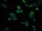 Bruton Tyrosine Kinase antibody, GTX84785, GeneTex, Immunofluorescence image 