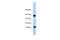 Pterin-4 Alpha-Carbinolamine Dehydratase 1 antibody, 25-068, ProSci, Western Blot image 