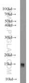AT-Rich Interaction Domain 4A antibody, 22683-1-AP, Proteintech Group, Western Blot image 