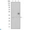 CD1a Molecule antibody, LS-C812527, Lifespan Biosciences, Enzyme Linked Immunosorbent Assay image 