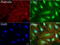 Carbonic Anhydrase 12 antibody, LS-C796773, Lifespan Biosciences, Immunofluorescence image 
