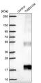 Transmembrane Protein 104 antibody, PA5-60676, Invitrogen Antibodies, Western Blot image 