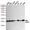 Growth Factor Receptor Bound Protein 2 antibody, STJ99118, St John