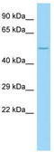 Collagen Type XXIII Alpha 1 Chain antibody, TA337795, Origene, Western Blot image 