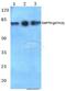 Zeta Chain Of T Cell Receptor Associated Protein Kinase 70 antibody, A00754Y315, Boster Biological Technology, Western Blot image 