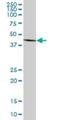 Betaine--Homocysteine S-Methyltransferase 2 antibody, H00023743-B01P, Novus Biologicals, Western Blot image 
