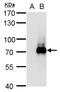 Tripartite Motif Containing 32 antibody, GTX113937, GeneTex, Western Blot image 