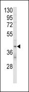 Killer Cell Immunoglobulin Like Receptor, Two Ig Domains And Long Cytoplasmic Tail 4 antibody, LS-C165527, Lifespan Biosciences, Western Blot image 