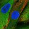 AB1IP antibody, NBP2-14300, Novus Biologicals, Immunofluorescence image 