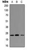 Triggering Receptor Expressed On Myeloid Cells 1 antibody, LS-C354319, Lifespan Biosciences, Western Blot image 