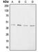 Aggrecan antibody, orb213537, Biorbyt, Western Blot image 