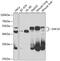 Zinc Finger Protein 24 antibody, GTX33590, GeneTex, Western Blot image 