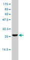 Uroporphyrinogen III Synthase antibody, LS-C198415, Lifespan Biosciences, Western Blot image 