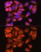 Outer dense fiber protein 2 antibody, GTX02526, GeneTex, Immunocytochemistry image 