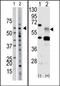 Activin A Receptor Type 1 antibody, AP14607PU-N, Origene, Western Blot image 