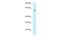 Clathrin Interactor 1 antibody, PA5-70573, Invitrogen Antibodies, Western Blot image 