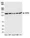 Coatomer subunit alpha antibody, A304-515A, Bethyl Labs, Western Blot image 