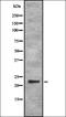 RAB35, Member RAS Oncogene Family antibody, orb337506, Biorbyt, Western Blot image 