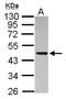 Phosphoribosylaminoimidazole Carboxylase And Phosphoribosylaminoimidazolesuccinocarboxamide Synthase antibody, NBP2-15290, Novus Biologicals, Western Blot image 