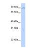 Apoptosis Resistant E3 Ubiquitin Protein Ligase 1 antibody, NBP1-59393, Novus Biologicals, Western Blot image 