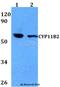 Cytochrome P450 11B2, mitochondrial antibody, A01150, Boster Biological Technology, Western Blot image 