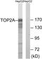 DNA Topoisomerase II Alpha antibody, LS-C118335, Lifespan Biosciences, Western Blot image 