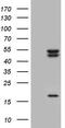 Casein Kinase 1 Epsilon antibody, TA803801S, Origene, Western Blot image 