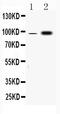 Fibrinogen Alpha Chain antibody, A00816-1, Boster Biological Technology, Western Blot image 