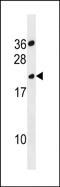 Transmembrane protease serine 11B-like protein antibody, PA5-72111, Invitrogen Antibodies, Western Blot image 