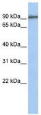 G2 And S-Phase Expressed 1 antibody, TA344130, Origene, Western Blot image 