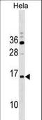 Ribonuclease P/MRP Subunit P14 antibody, LS-C158892, Lifespan Biosciences, Western Blot image 