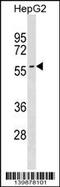 Sphingomyelin Phosphodiesterase 3 antibody, MBS9203057, MyBioSource, Western Blot image 