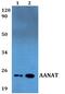 Aralkylamine N-Acetyltransferase antibody, PA5-75722, Invitrogen Antibodies, Western Blot image 