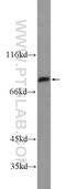 Transglutaminase-5 antibody, 25071-1-AP, Proteintech Group, Western Blot image 