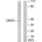 LIM Domain Only 4 antibody, A06555, Boster Biological Technology, Western Blot image 
