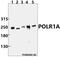 RNA Polymerase I Subunit A antibody, A10549, Boster Biological Technology, Western Blot image 