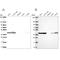 Serine/Threonine Kinase Receptor Associated Protein antibody, NBP2-38757, Novus Biologicals, Western Blot image 