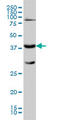 Galactose-1-Phosphate Uridylyltransferase antibody, LS-B5410, Lifespan Biosciences, Western Blot image 