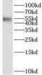 SET Domain Containing 6, Protein Lysine Methyltransferase antibody, FNab07768, FineTest, Western Blot image 