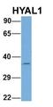 Hyaluronidase 1 antibody, orb330624, Biorbyt, Western Blot image 