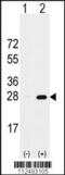 Proteasome Subunit Alpha 5 antibody, MBS9211975, MyBioSource, Western Blot image 