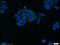 Tubulin Beta 3 Class III antibody, 10068-1-AP, Proteintech Group, Immunofluorescence image 