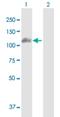 Protein Kinase D1 antibody, H00005587-B01P, Novus Biologicals, Western Blot image 