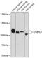 Oxysterol Binding Protein Like 8 antibody, 18-115, ProSci, Western Blot image 
